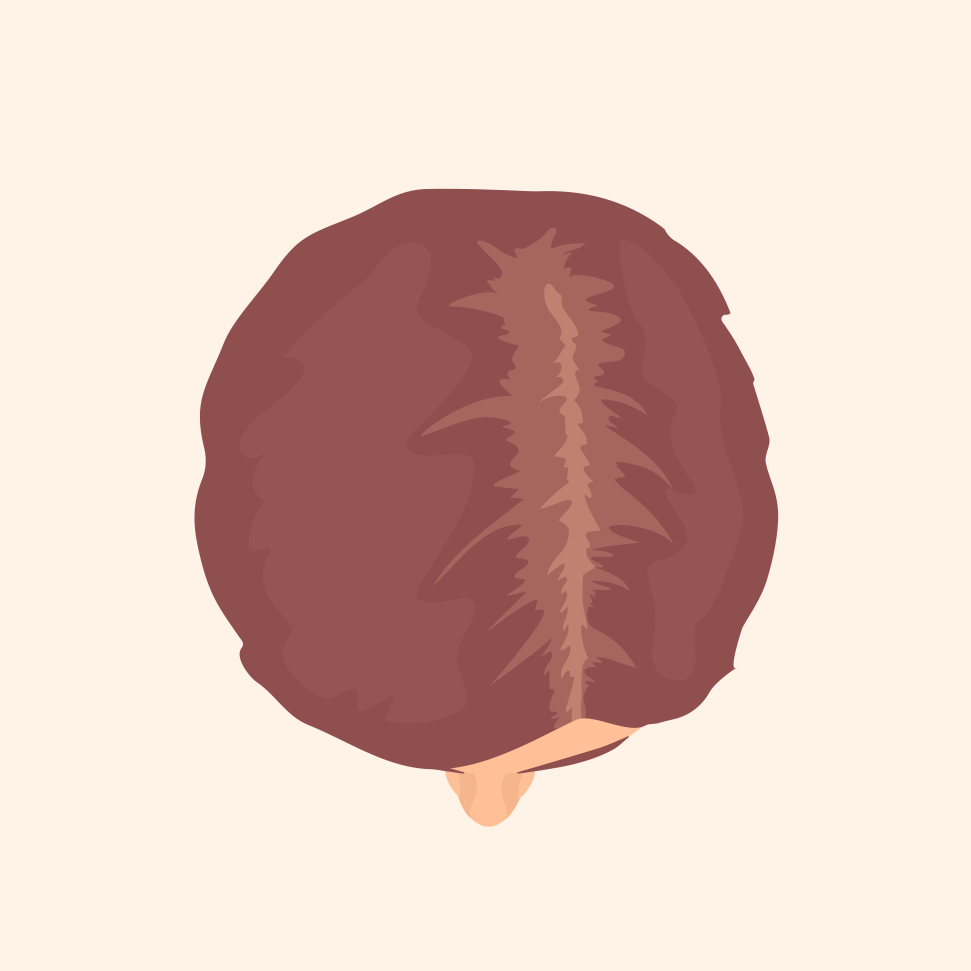 Hair loss not yet noticeable