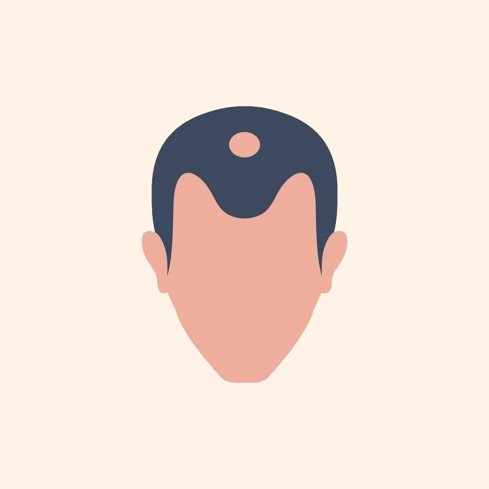 Stage 3
