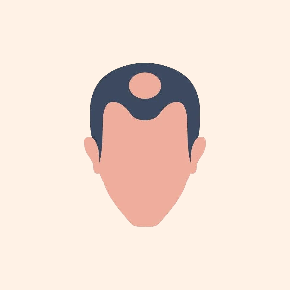 Stage 4