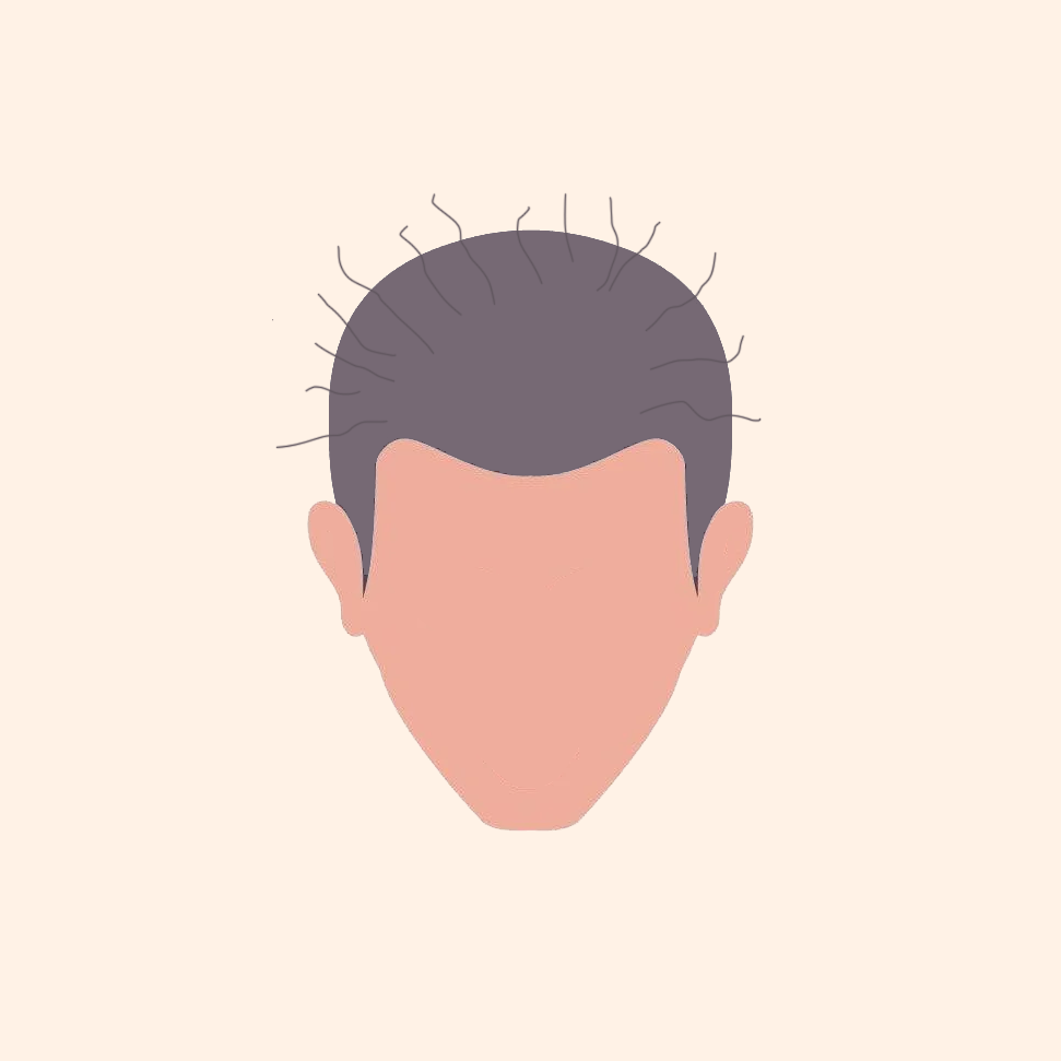 Thinning all over